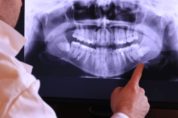 Best Emergency Treatment for Jaw Pain or Injury in Honea Path, SC